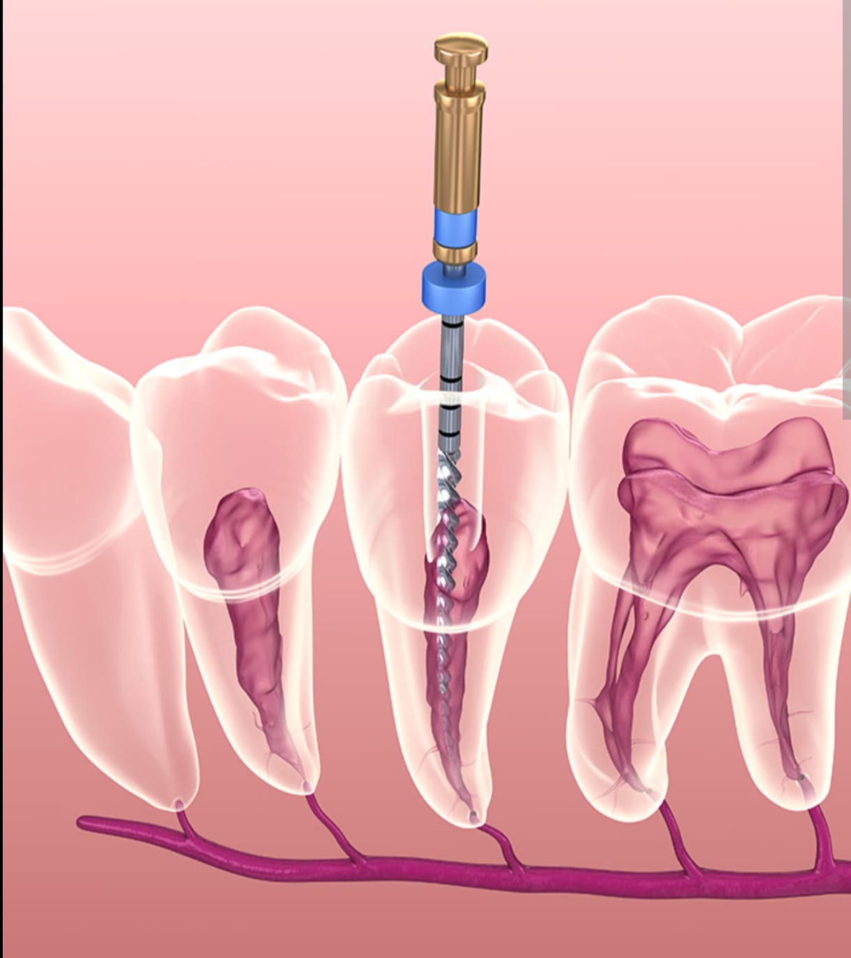 Endodoncia